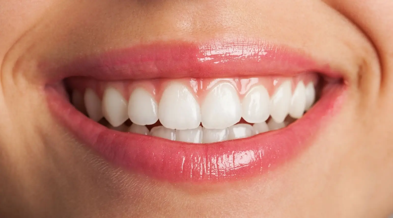 Smile Designing in Brookefield, Bangalore